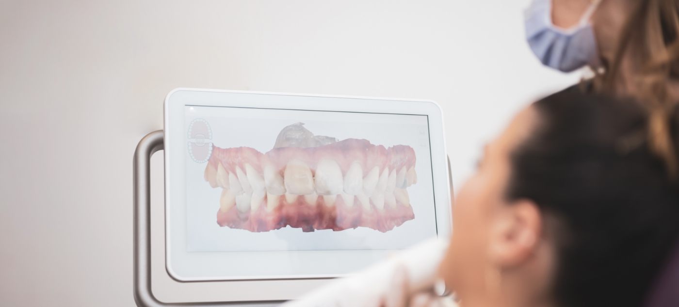 Dental patient looking at digital model of teeth on computer monitor