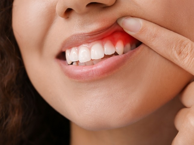 Close up of person pointing to red spot in their gums before gum disease treatment