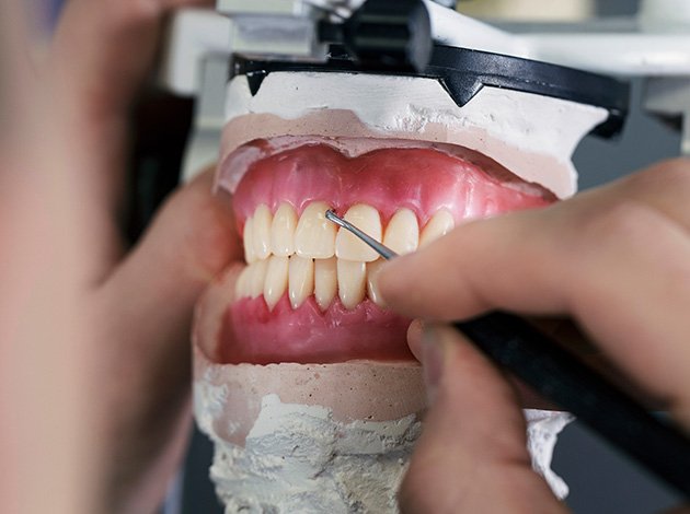 A dental lab technician making dentures in Dublin