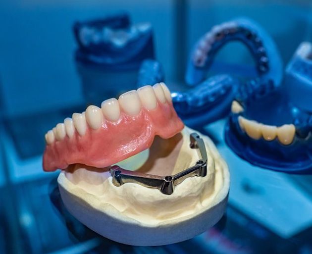 Denture being manufactured in lab