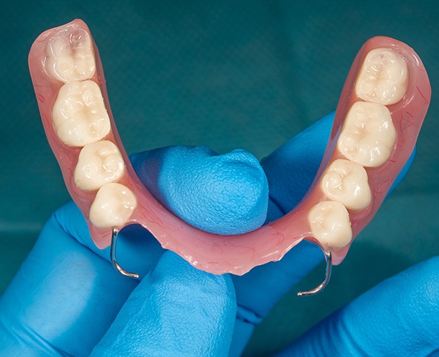 A close-up of a partial denture
