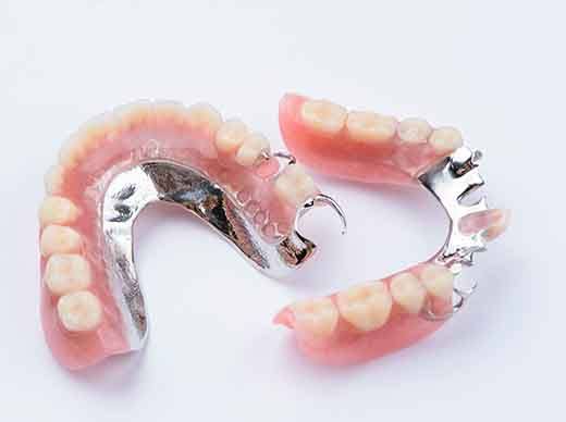 Set of partial dentures on a white surface