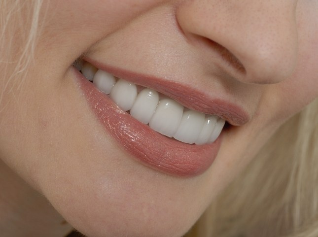 Close up of smile with flawless teeth