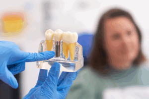 a patient and dentist talking about dental implants